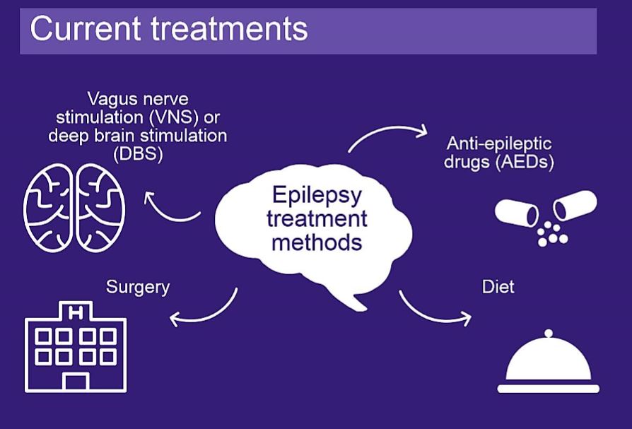 how-is-epilepsy-treated-neuro-central