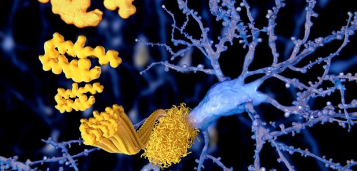 Nanodevices in the brain could target Alzheimer’s by clearing β‐Amyloid
