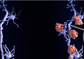 multiple sclerosis pregnancy